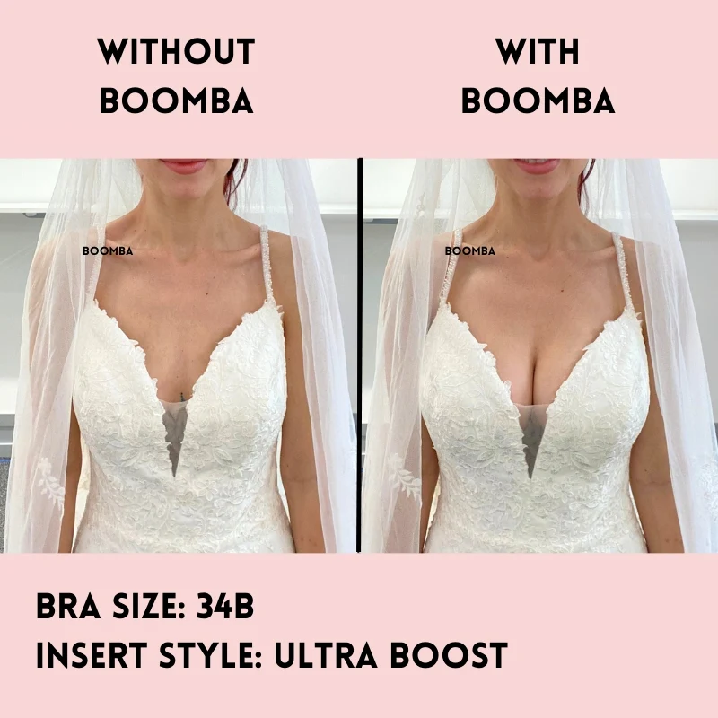 Bridal Bra Kit - Image 6