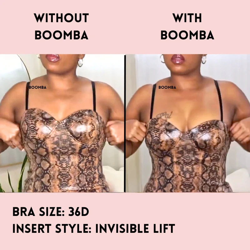 Invisible Lift Inserts - Image 30